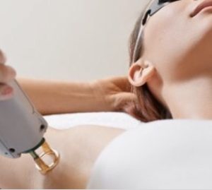 epilare definitiva IPL Cluj