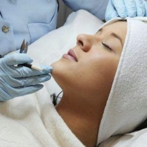 epilare definitiva IPL Cluj