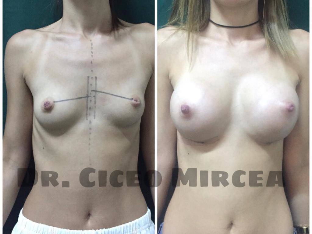 marire sani Cluj, clinica Medestet