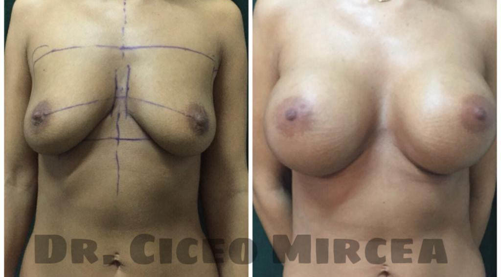 marire sani Cluj, clinica Medestet