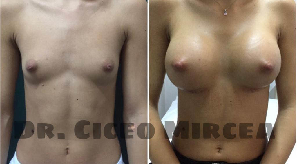 marire sani Cluj, clinica Medestet